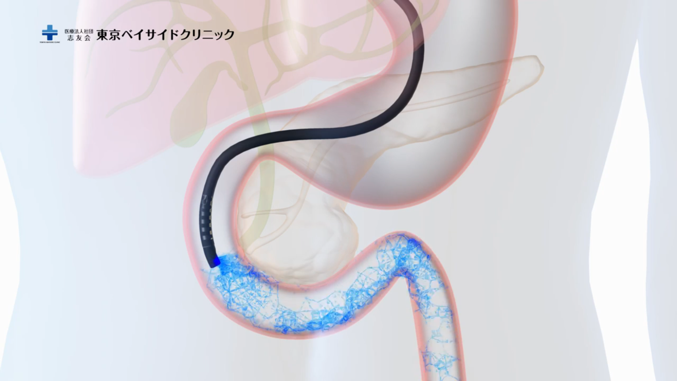 GEIIの流れ 図解